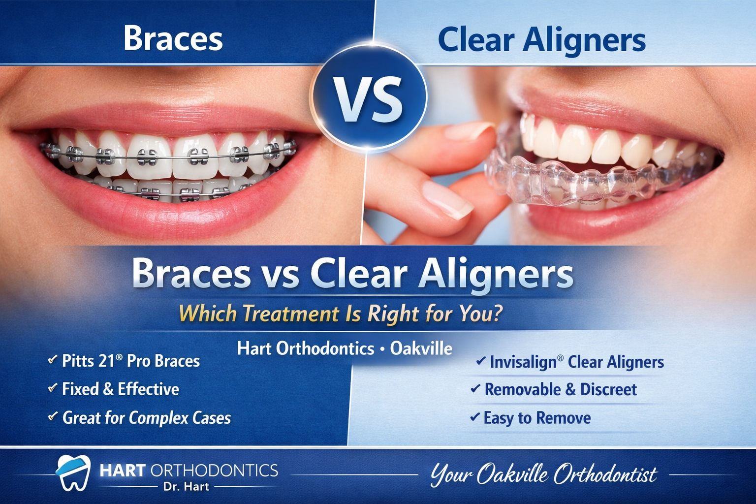 Braces vs clear aligners comparison at Hart Orthodontics in Oakville Ontario